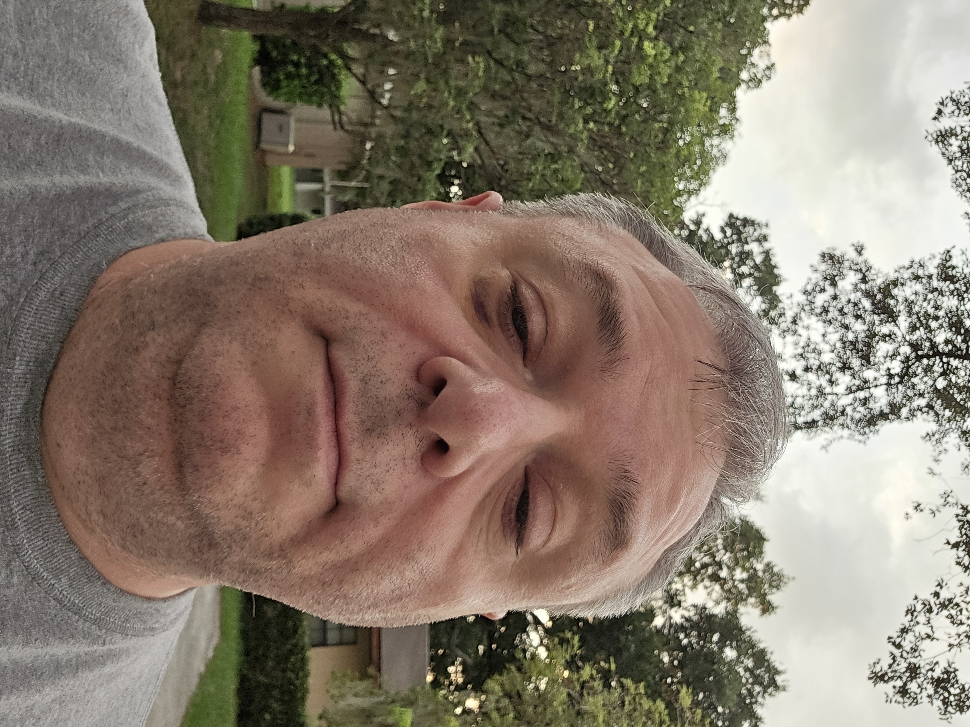 Close-up selfie of a middle-aged man with short, graying hair and light skin. He has a noticeable dark bruise under his left eye. His eyes are partially closed, and his expression is neutral. He is wearing a gray shirt. The background shows an outdoor setting with green trees and bushes, a grassy area, and parts of a beige building with windows and an air conditioning unit. The sky is overcast with light gray clouds. The photo is taken from a low angle, capturing the man's face from below.